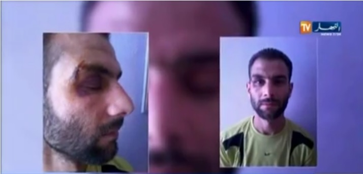 جزائري يتهم ستة اعوان أمن وديواني تونسي بالاعتداء عليه بالعنف الشديد